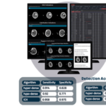 ct-brain-4